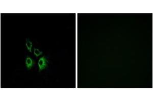 Immunofluorescence analysis of A549 cells, using ADRA1A Antibody. (alpha 1 Adrenergic Receptor antibody  (AA 136-185))
