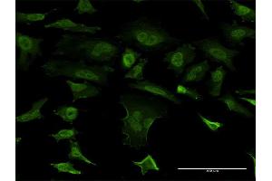 Immunofluorescence of monoclonal antibody to SNCB on HeLa cell. (beta Synuclein antibody  (AA 1-134))