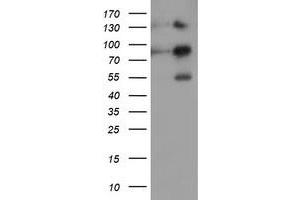 HEK293T cells were transfected with the pCMV6-ENTRY control (Left lane) or pCMV6-ENTRY FOLH1 (Right lane) cDNA for 48 hrs and lysed. (PSMA antibody)