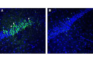 Expression of 5HT2C in mouse hippocampus.