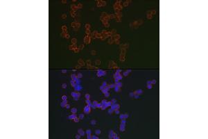 Immunofluorescence analysis of Raji cells using CD20 Rabbit pAb (ABIN7268473) at dilution of 1:150 (40x lens). (CD20 antibody  (AA 208-297))