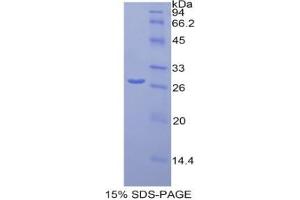 SDS-PAGE analysis of Mouse Orosomucoid 1 Protein. (ORM1 Protein)