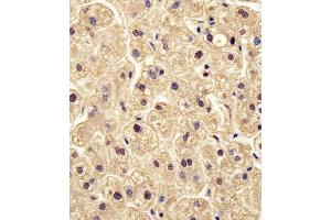 Antibody staining PGM1 in human liver tissue sections by Immunohistochemistry (IHC-P - paraformaldehyde-fixed, paraffin-embedded sections).