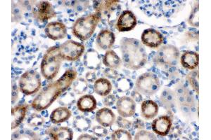 Anti-NOX1 antibody, HC(P) HC(P): Rat Kidney Tissue (NOX1 antibody  (Middle Region))