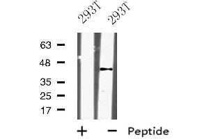 Western blot analysis of KLF12 expression in 293T whole cell lysate ,The lane on the left is treated with the antigen-specific peptide.