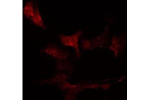 ABIN6276467 staining  HeLa cells by IF/ICC. (IRF4 antibody  (C-Term))