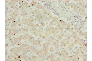 Immunohistochemistry of paraffin-embedded human liver tissue using ABIN7144733 at dilution of 1:100 (GOT2 antibody  (AA 33-279))