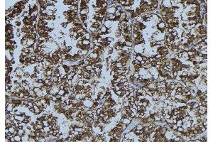 ABIN6276378 at 1/100 staining Mouse testis tissue by IHC-P. (DDX58 antibody  (N-Term))
