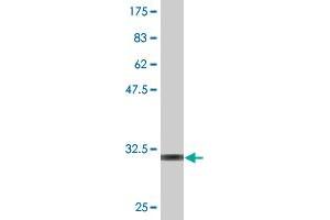 Western Blot detection against Immunogen (32. (KAT2B antibody  (AA 367-432))