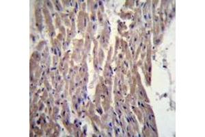 Immunohistochemistry analysis in human heart tissue (Formalin-fixed, Paraffin-embedded) using MYBPC3 Antibody (N-term), followed by peroxidase conjugated secondary antibody and DAB staining. (MYBPC3 antibody  (N-Term))