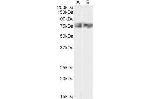 ABIN5539550 (1µg/ml) staining of HeLa (A) and NIH3T3 (B) lysate (35µg protein in RIPA buffer). (LIMK2 antibody  (AA 181-193))