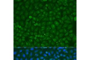 Immunofluorescence analysis of U2OS cells using COG4 Polyclonal Antibody at dilution of 1:100. (COG4 antibody)