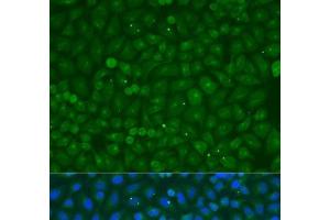 Immunofluorescence analysis of U2OS cells using COG4 Polyclonal Antibody at dilution of 1:100. (COG4 antibody)