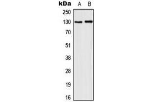 Western blot analysis of CD131 (pY593) expression in MCF7 IL1b-treated (A), HepG2 LPS-treated (B) whole cell lysates. (CD131 antibody  (pTyr593))
