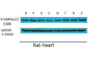 Western Blot (WB) analysis: Please contact us for more details. (PRKAA1/PRKAA2 antibody  (pThr172, pThr183))