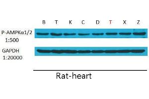 Western Blot (WB) analysis: Please contact us for more details. (PRKAA1/PRKAA2 antibody  (pThr172, pThr183))