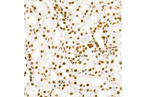 Immunohistochemistry of paraffin-embedded rat kidney using Phospho-ST-Y705 Rabbit mAb (ABIN6135325, ABIN6136266, ABIN6136267 and ABIN7101883) at dilution of 1:100 (40x lens). (STAT3 antibody  (pTyr705))