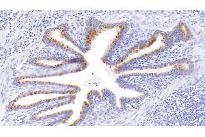 Detection of MMP2 in Human Lung Tissue using Polyclonal Antibody to Matrix Metalloproteinase 2 (MMP2) (MMP2 antibody  (AA 445-660))