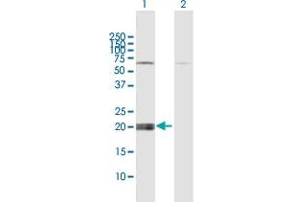 IFNE antibody  (AA 1-208)