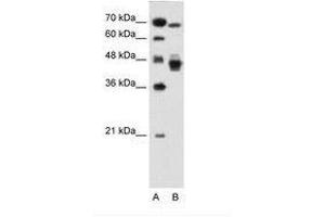 Image no. 1 for anti-Nuclear Receptor Subfamily 2, Group F, Member 6 (NR2F6) (AA 21-70) antibody (ABIN6736681) (NR2F6 antibody  (AA 21-70))