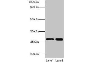 Western blot All lanes: LGALS3 antibody at 2 μg/mL Lane 1: Hela whole cell lysate Lane 2: MCF-7 whole cell lysate Secondary Goat polyclonal to rabbit IgG at 1/10000 dilution Predicted band size: 27 kDa Observed band size: 27 kDa (Galectin 3 antibody  (AA 2-250))