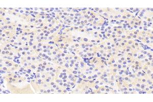 Detection of GTF2H5 in Human Kidney Tissue using Polyclonal Antibody to General Transcription Factor IIH, Polypeptide 5 (GTF2H5) (GTF2H5 antibody  (AA 1-71))