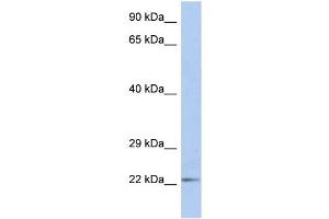 DUT antibody used at 1 ug/ml to detect target protein. (Deoxyuridine Triphosphatase (DUT) (N-Term) antibody)