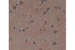 Immunohistochemistry (IHC) image for anti-Small Ubiquitin Related Modifier Protein 1 (SUMO1) (AA 1-101) antibody (ABIN1871260)