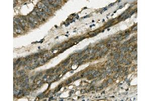 IHC analysis of FABP6 using anti-FABP6 antibody (ABIN7598974).