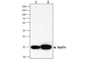 Western Blotting (WB) image for anti-Leptin (LEP) antibody (ABIN2665227) (Leptin antibody)