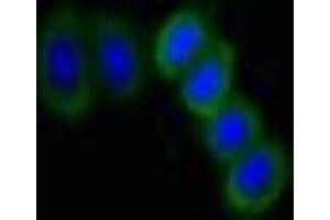 Immunofluorescent analysis of HepG2 cells using ABIN7169807 at dilution of 1:100 and Alexa Fluor 488-congugated AffiniPure Goat Anti-Rabbit IgG(H+L) (SLITRK6 antibody  (AA 621-821))