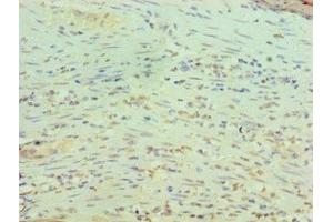 Immunohistochemistry of paraffin-embedded human epityphlon tissue using ABIN7167786 at dilution of 1:100 (RBBP5 antibody  (AA 319-538))