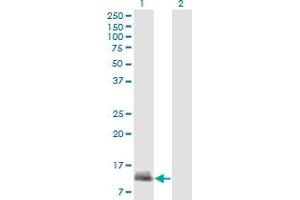 Western Blot analysis of CARD17 expression in transfected 293T cell line by CARD17 monoclonal antibody (M01A), clone 1G6. (CARD17 antibody  (AA 1-110))