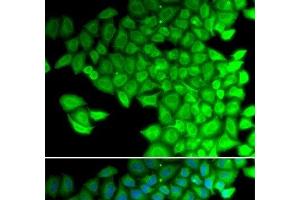 Immunofluorescence analysis of HeLa cells using MYL2 Polyclonal Antibody (MYL2 antibody)