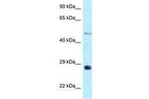 Image no. 1 for anti-1-Acylglycerol-3-Phosphate O-Acyltransferase 9 (AGPAT9) (AA 199-248) antibody (ABIN6748085) (AGPAT9 antibody  (AA 199-248))