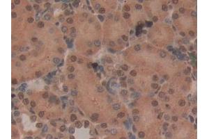Immunohistochemistry (IHC) image for anti-CD2-Associated Protein (Cd2ap) (AA 368-623) antibody (ABIN7439519)
