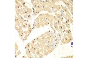 Immunohistochemistry of paraffin-embedded mouse heart using HIF1AN antibody. (HIF1AN antibody  (AA 1-349))
