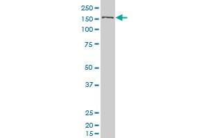 SMC1L1 polyclonal antibody (A01), Lot # 051003JC01 Western Blot analysis of SMC1L1 expression in 293 . (SMC1A antibody  (AA 366-465))