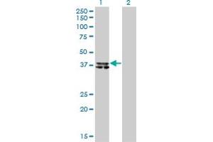 Western Blot analysis of B4GALT4 expression in transfected 293T cell line by B4GALT4 monoclonal antibody (M01), clone 5E2. (B4GALT4 antibody  (AA 35-134))