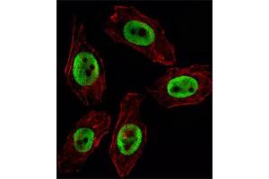 Immunofluorescent staining of U251 cell reacted with EZH2 monoclonal antibody  at 1:10-1:50 dilution.