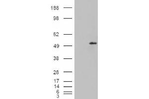 Image no. 2 for anti-STEAP Family Member 4 (STEAP4) (C-Term) antibody (ABIN375107) (STEAP4 antibody  (C-Term))