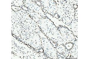 IHC analysis of MCM6 using anti-MCM6 antibody (ABIN7600037).