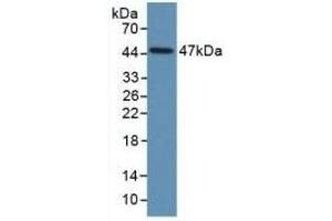 Detection of Recombinant PAI1, Human using Monoclonal Antibody to Plasminogen Activator Inhibitor 1 (PAI1) (PAI1 antibody)