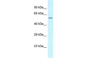 WB Suggested Anti-CLINT1 Antibody Titration: 1. (CLINT1 antibody  (N-Term))