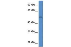 Image no. 1 for anti-Arylsulfatase B (ARSB) (AA 300-349) antibody (ABIN6747289) (Arylsulfatase B antibody  (AA 300-349))