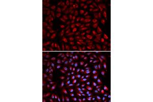 Immunofluorescence analysis of U2OS cell using RARA antibody. (Retinoic Acid Receptor alpha antibody)