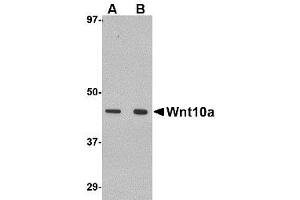 Image no. 1 for anti-Wingless-Type MMTV Integration Site Family, Member 10A (WNT10A) (C-Term) antibody (ABIN1492215) (WNT10A antibody  (C-Term))