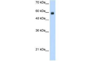WB Suggested Anti-RCOR1 Antibody Titration:  1. (CoREST antibody  (N-Term))