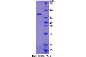 Image no. 1 for E1A Binding Protein P300 (EP300) (AA 1351-1601) protein (His tag) (ABIN6239967) (p300 Protein (AA 1351-1601) (His tag))