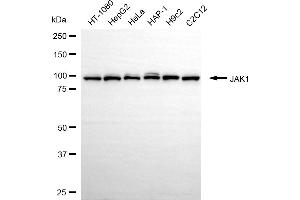 Western blotting analysis using JAK1 antibody (ABIN7799139).